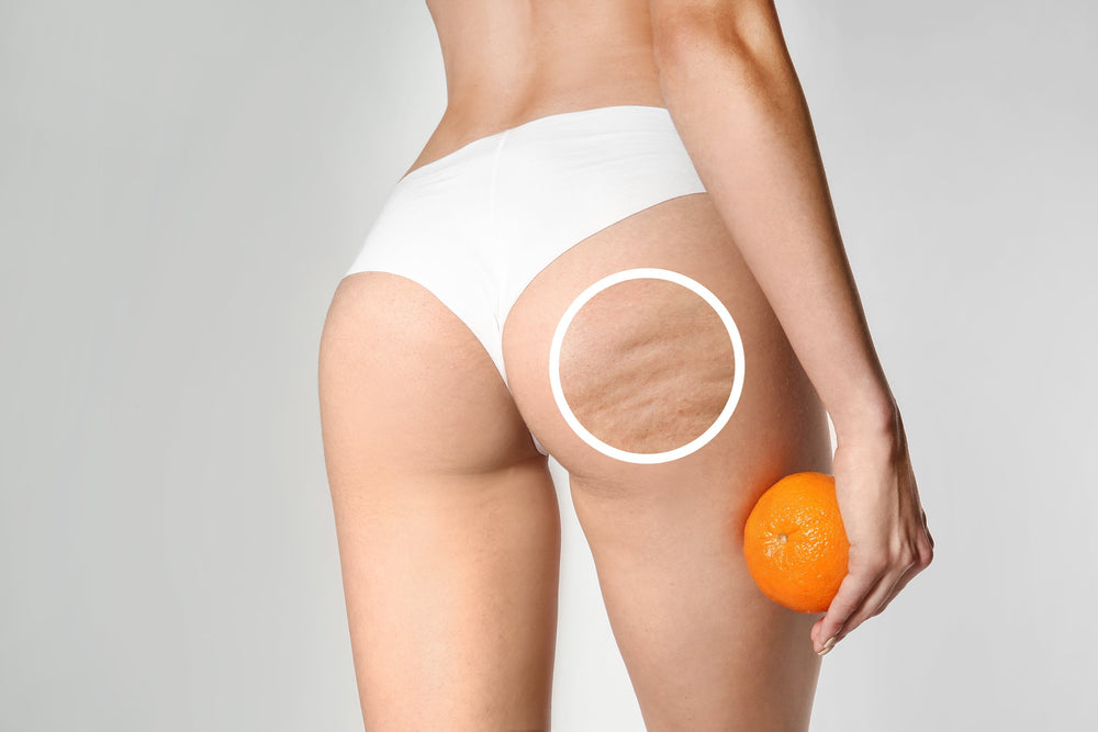 Tout ce que vous devez savoir sur la cellulite par LÏV Happy Food